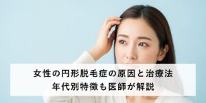 女性の円形脱毛症の原因と治し方