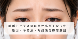 【医師監修】額ボトックス後に目が小さくなった…原因・予防法・対処法を徹底解説