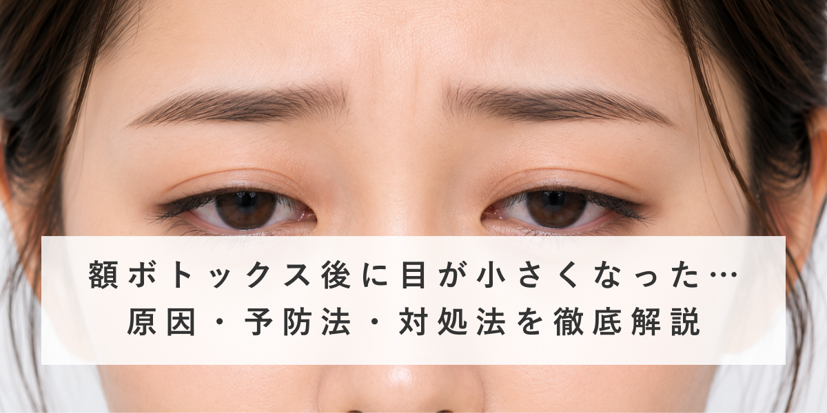 額ボトックスで目が小さくなる原因とは