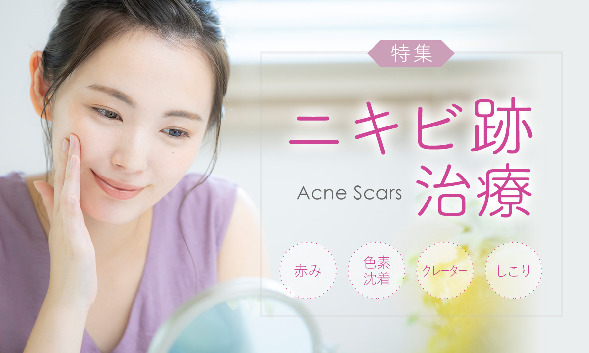 ニキビ跡治療を大阪でお探しなら美容皮膚科の当院へ！お一人お一人のお肌を丁寧に診察し、最適な治療のご提案に加え、毎日のスキンケアのアドバイス
