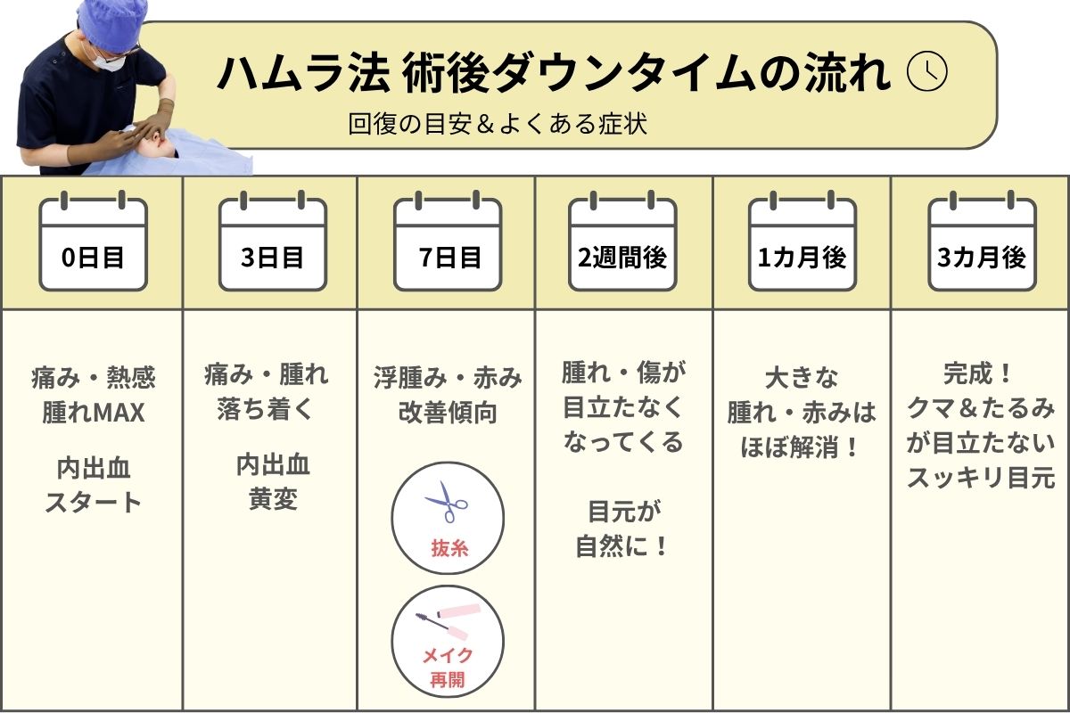 ハムラ法のダウンタイム経過