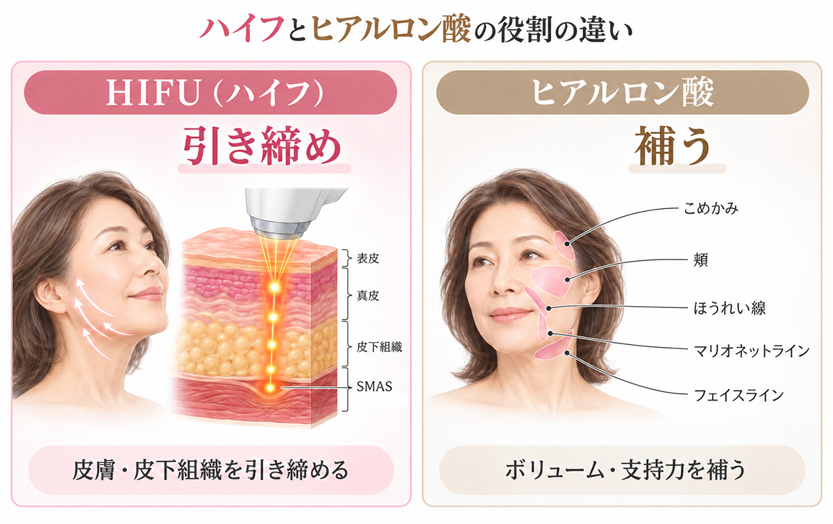 ハイフとヒアルロン酸の役割の違い