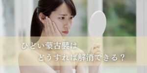ひどい蒙古襞はどうすれば解消できる？