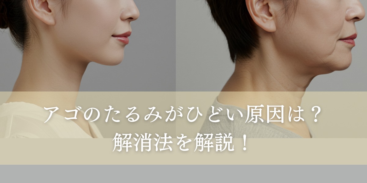 アゴのたるみがひどい原因は？解消するためのセルフケアや治療法を解説！