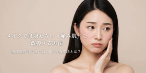 メイクでは隠せない「赤み肌」を改善する方法｜医師監修の本当に効く5つの治療法とは？