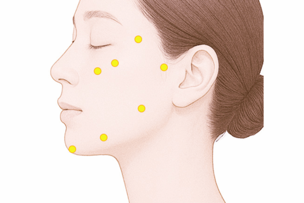 ジャルプロスーパーハイドロの注入ポイント