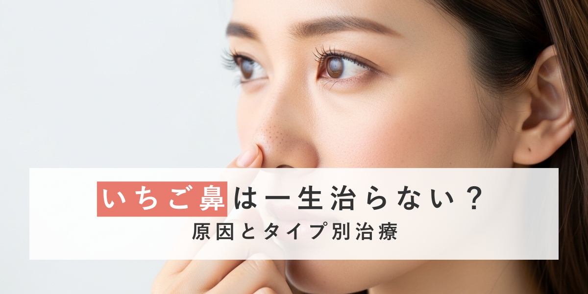 いちご鼻は一生治らない？黒ずみの原因とタイプ別の正しい治し方を解説
