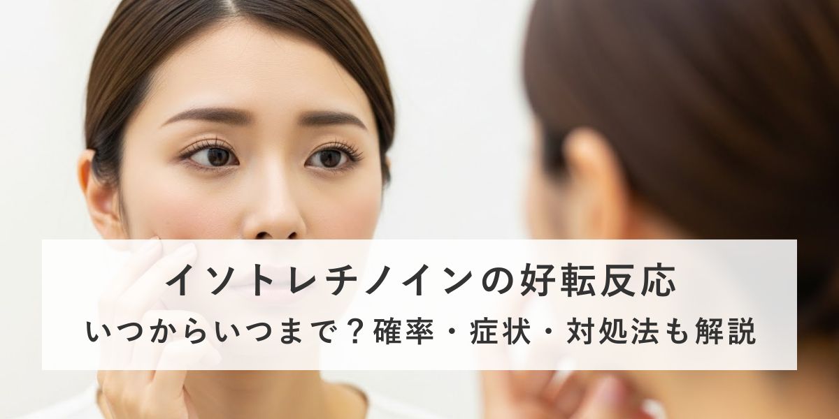 イソトレチノインの好転反応はいつからいつまで？確率や期間、症状まで医師が徹底解説