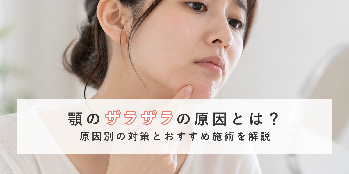 顎のザラザラを改善する方法｜原因別の対策とおすすめ施術