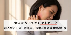 【大人になってからアトピー？】成人型アトピーの原因・特徴と最新の治療選択肢
