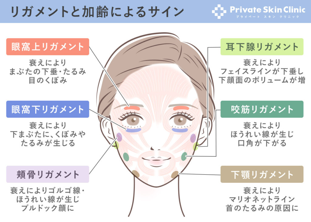 顔を支えるリガメント（靭帯）としわとたるみの原因となる加齢によるサイン