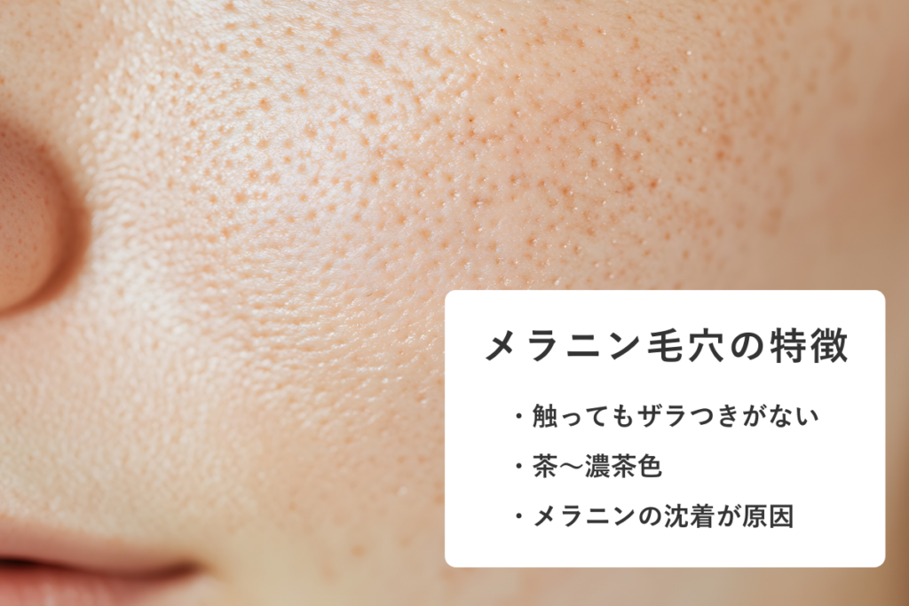 メラニン毛穴