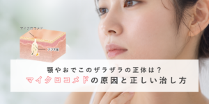 顎やおでこのザラザラの正体は？マイクロコメドの原因と正しい治し方