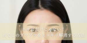 これってニキビじゃない？おでこのブツブツを解消する方法