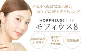 モフィウス8