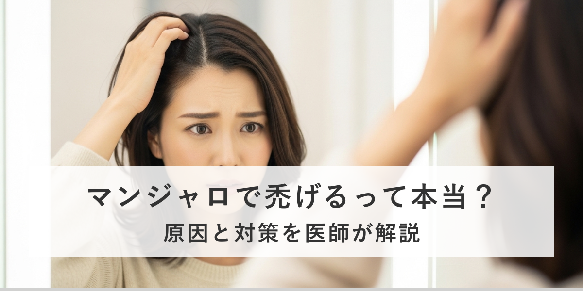 マンジャロで「禿げる」は本当？副作用について