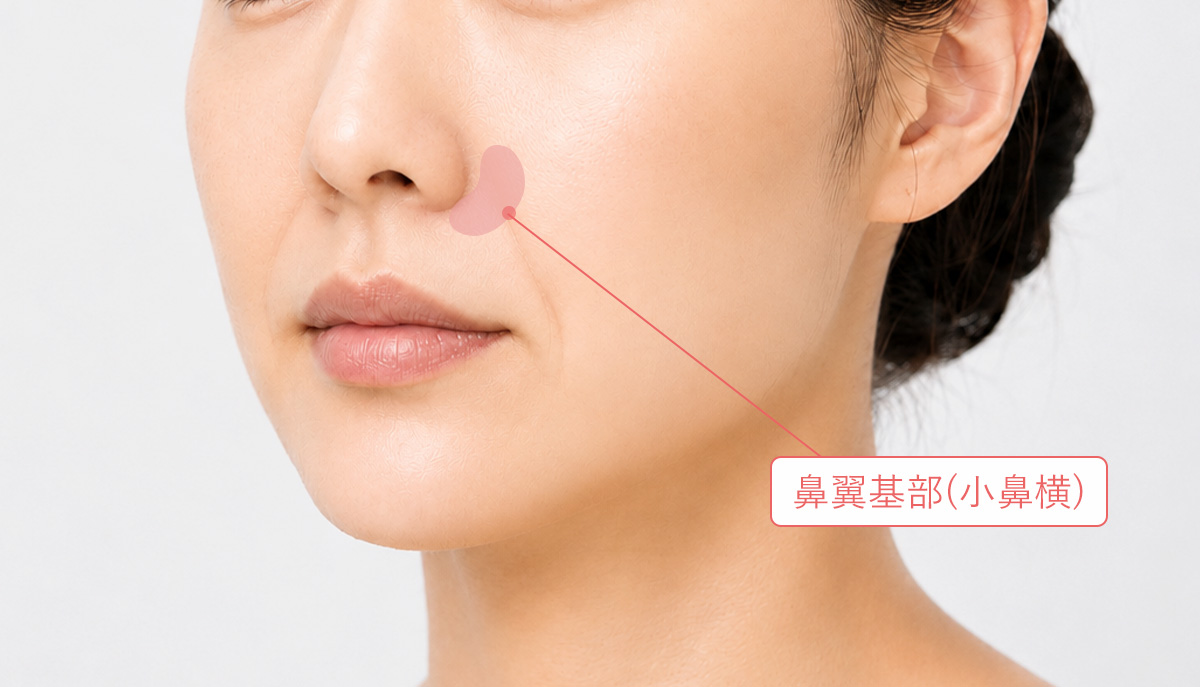 鼻翼基部（小鼻横）