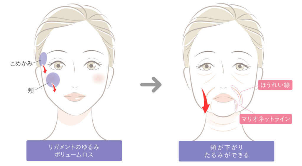 加齢によるシワやたるみの原因