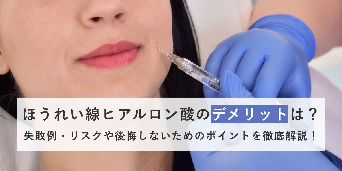 ほうれい線ヒアルロン酸のデメリットは？リスクや注意点を詳しく解説