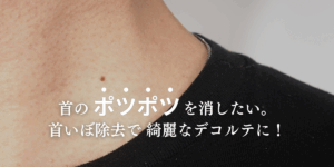 首のポツポツを消したい。首いぼ除去で 綺麗なデコルテに！