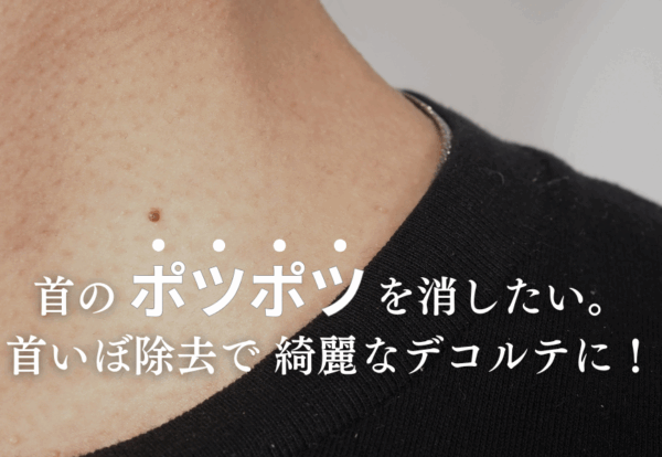首のポツポツを消したい。首いぼ除去で 綺麗なデコルテに！