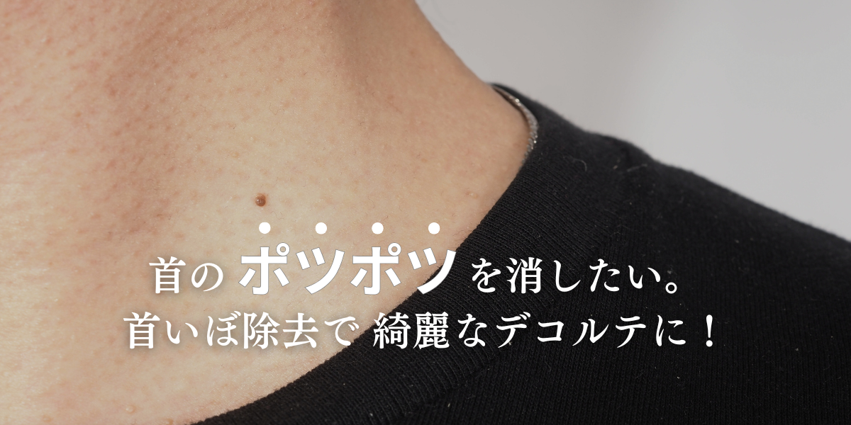 首いぼ除去で美しい首元・デコルテへ