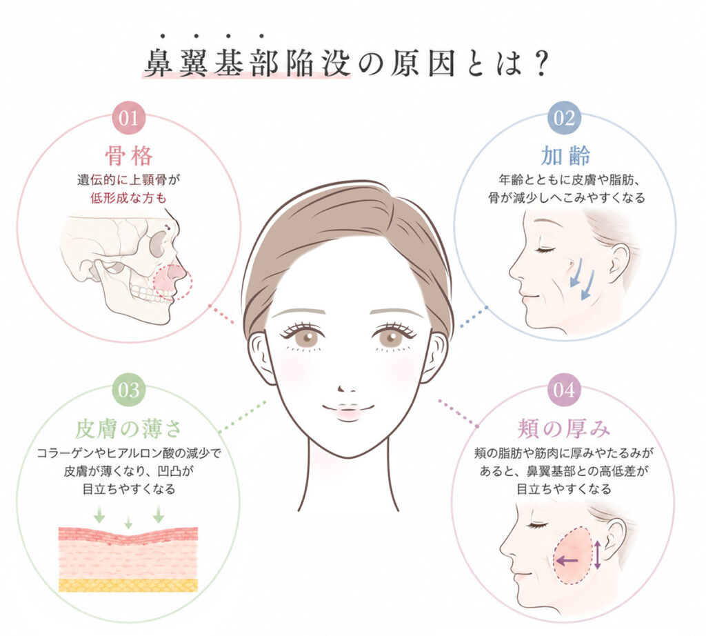 鼻翼基部陥没の原因