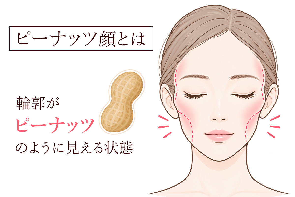 ピーナッツ顔とは