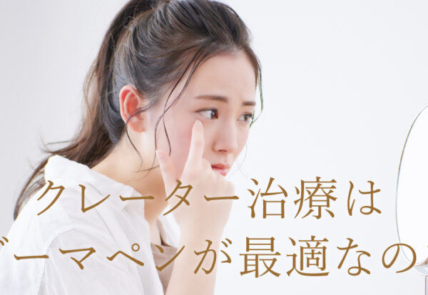 クレーター治療はダーマペンが最適なの？