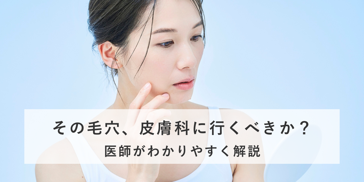 その毛穴、皮膚科に行くべきか？医師がわかりやすく解説