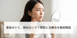 産後のシミ、諦めないで！原因と治療法を徹底解説