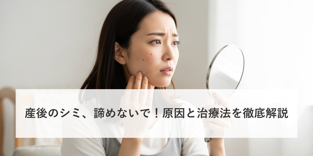 産後のシミ、諦めないで！原因と治療法を徹底解説