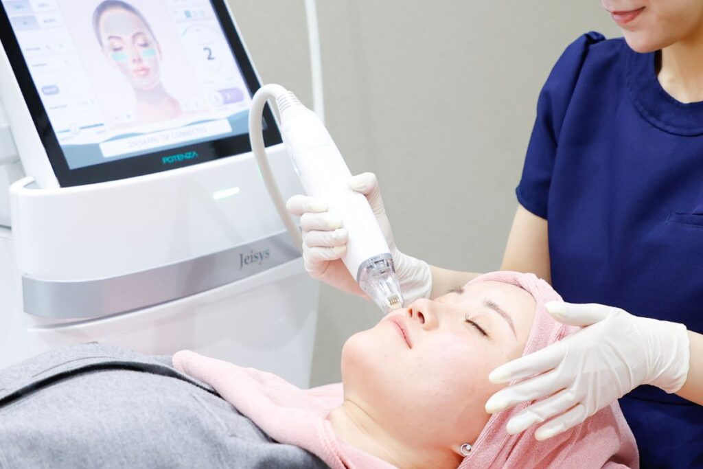 ポテンツァの施術の様子