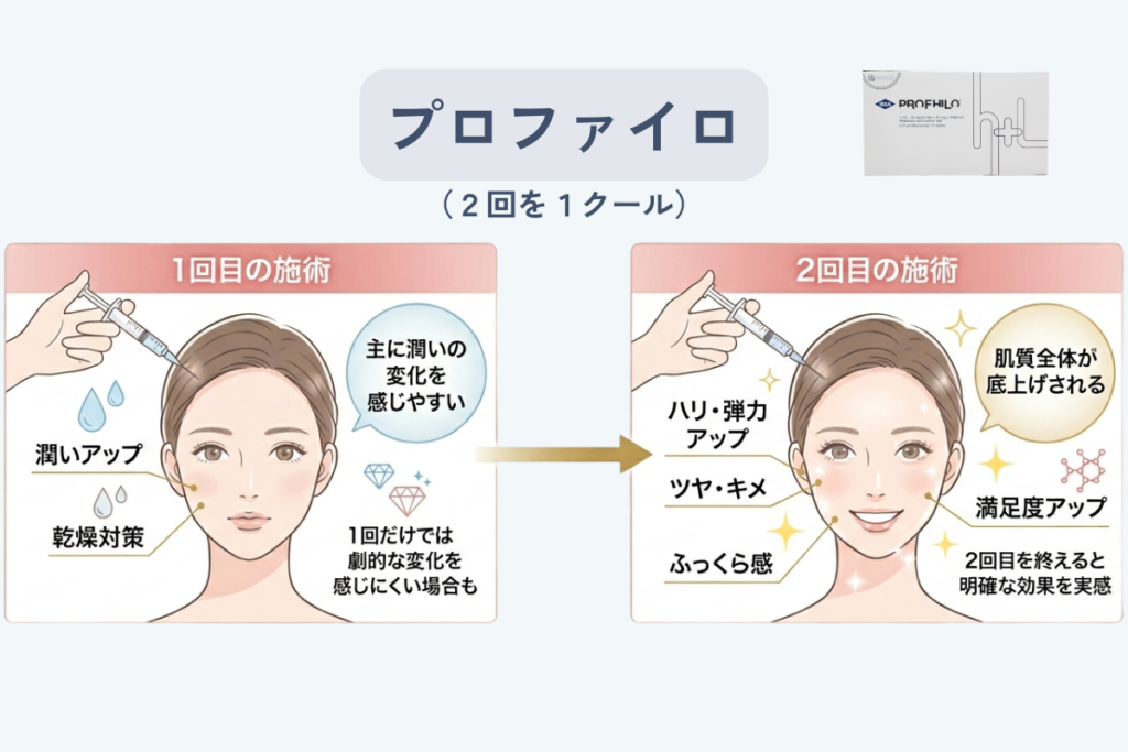 プロファイロは1回では物足りなく感じる