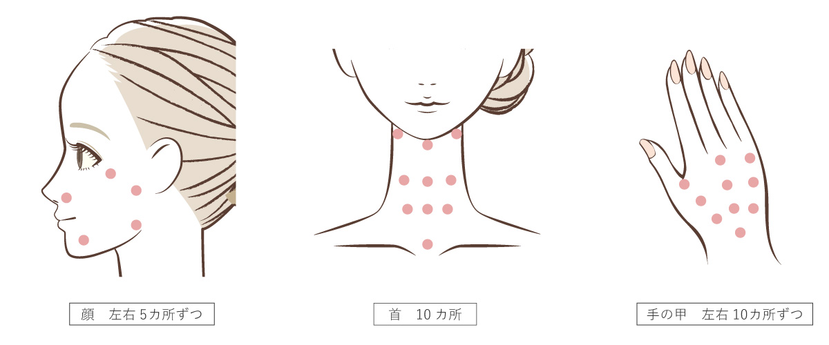 プロファイロの注入箇所