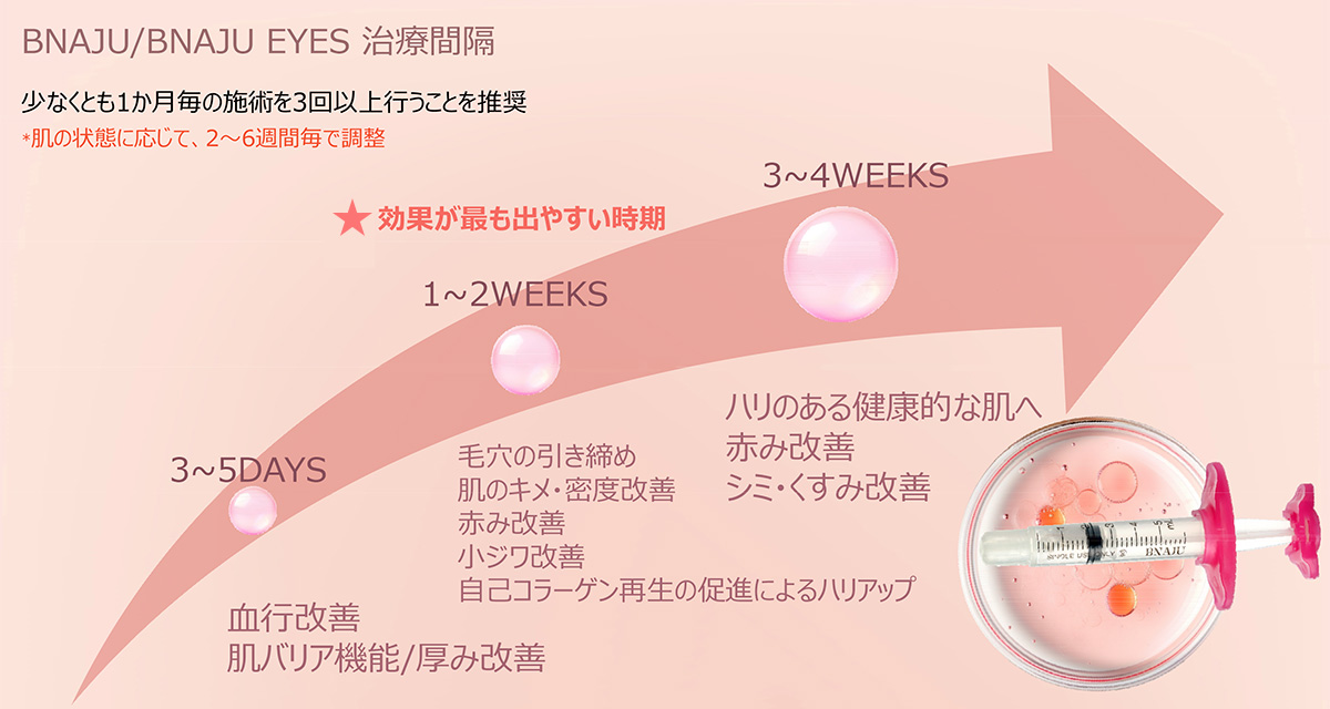 リトゥオ（Re2O）／ブナジュの治療間隔
