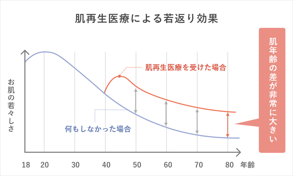 肌再生医療を受けた場合の肌年齢の推移イメージイラスト