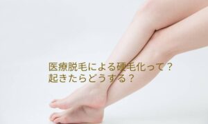 医療脱毛による硬毛化って？起きたらどうする？
