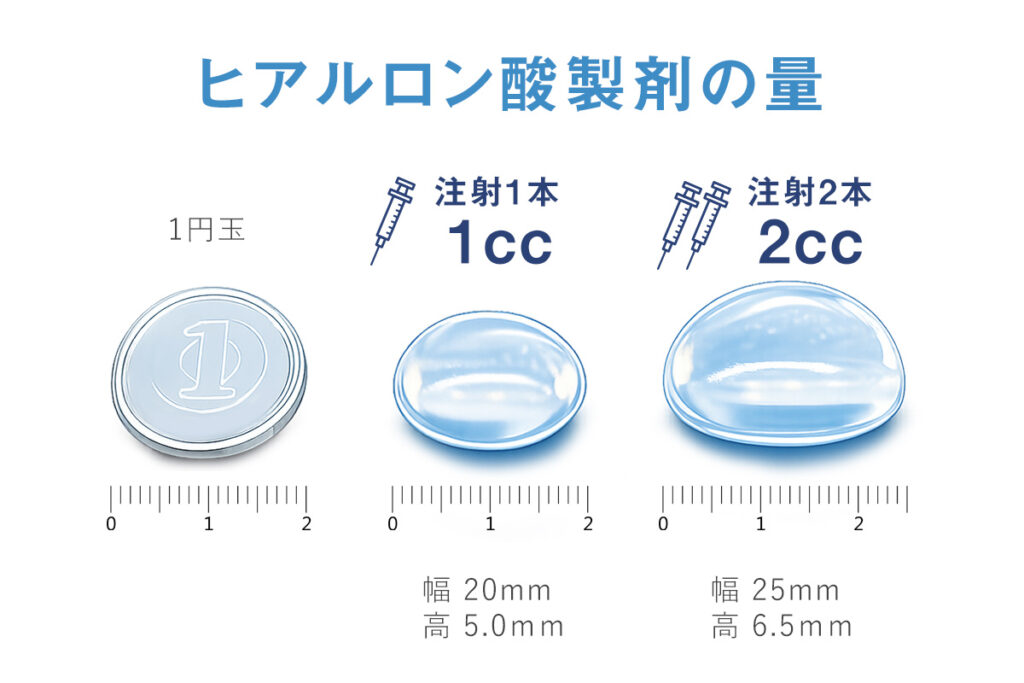 ヒアルロン酸製剤の量　1ccはヒアルロン酸製剤注射1本分　2ccはヒアルロン酸製剤注射2本分です(プライベートスキンクリニック)