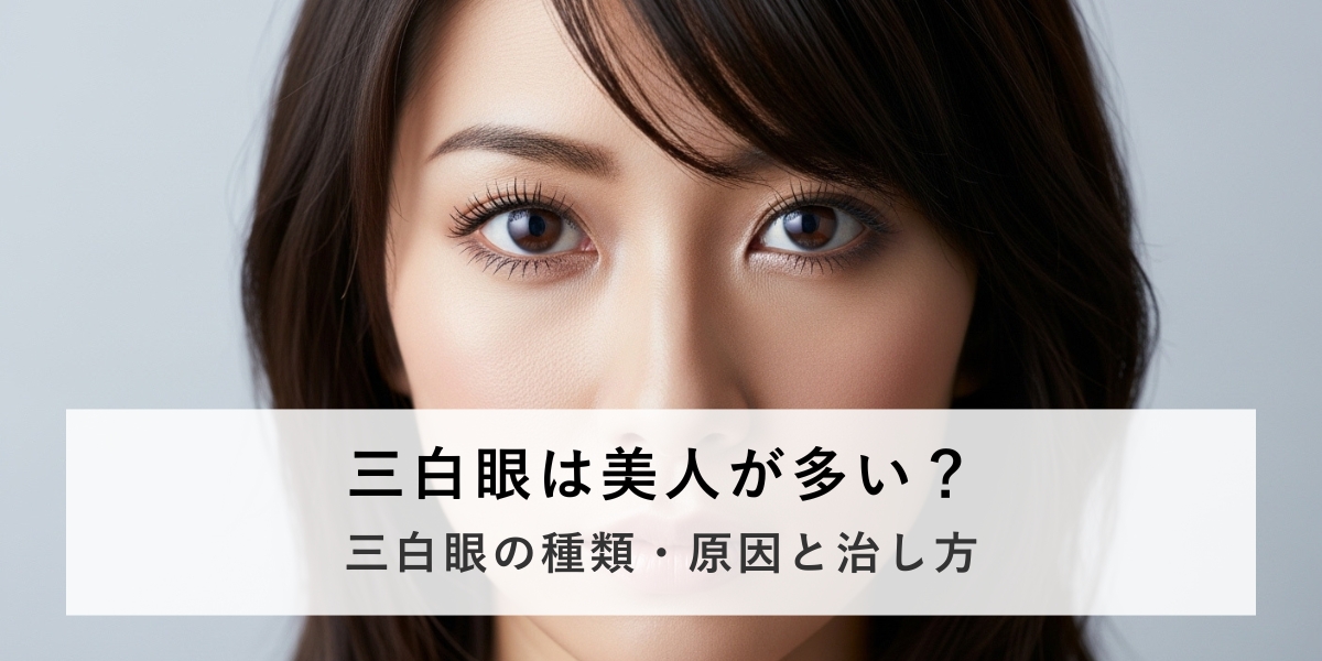 三白眼は美人が多いって本当？原因や治療方法を医師が解説