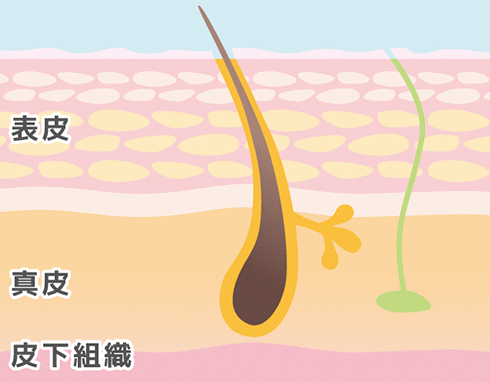 しわ・たるみの原因　表皮・真皮・皮下組織の3層構造