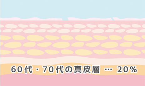 しわ・たるみの原因　60台・70代の真皮層