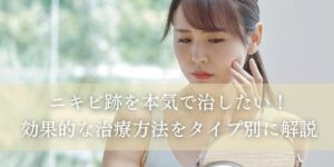 ニキビ跡の種類別ケア　自分に合った治療で美肌に！
