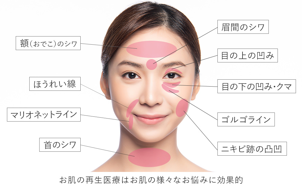 お肌の再生医療は様々なお肌のお悩みに効果的な治療