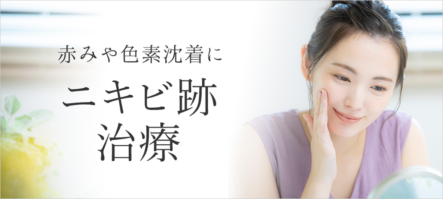 色素沈着などのニキビ跡治療特集はこちら