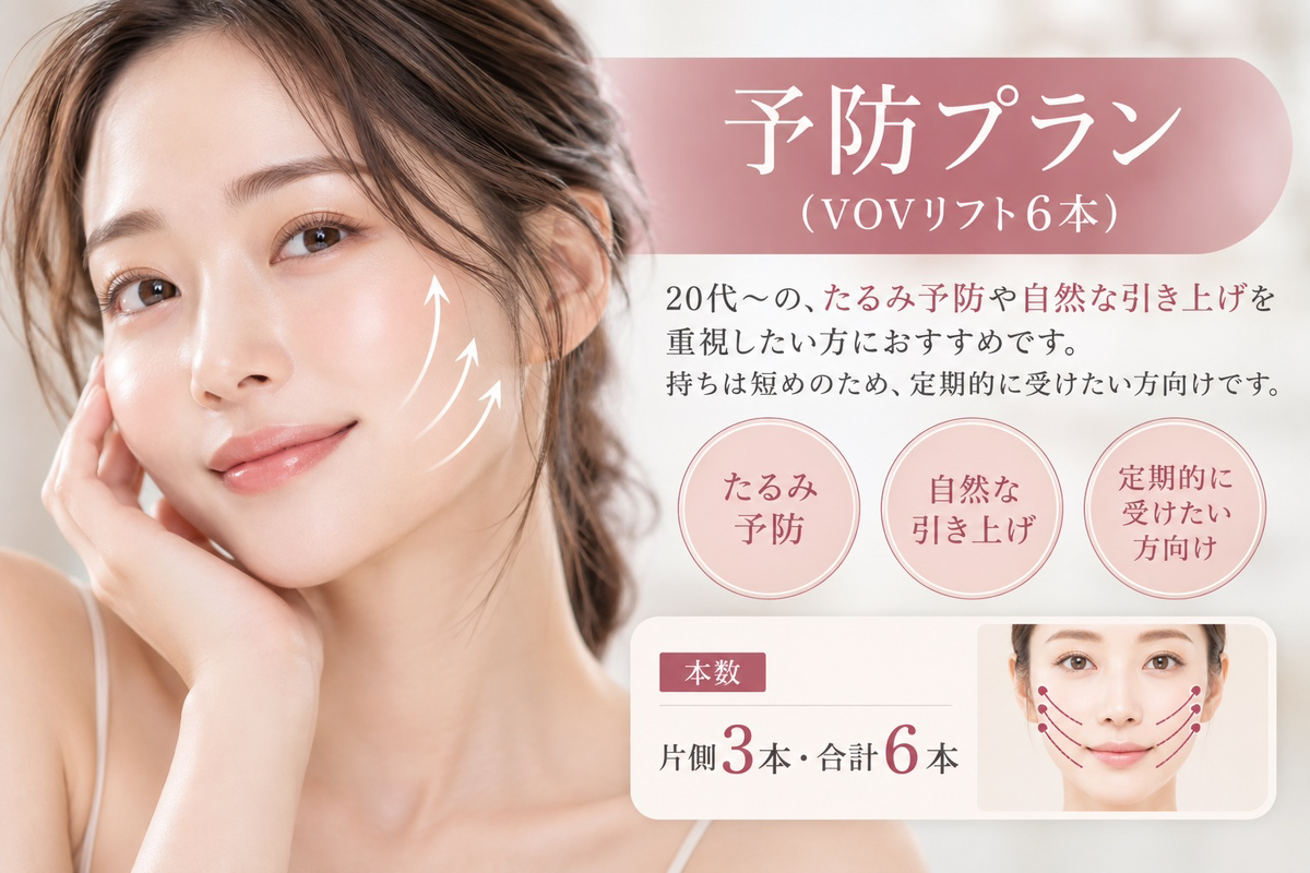 糸リフト（スレッドリフト）予防プラン