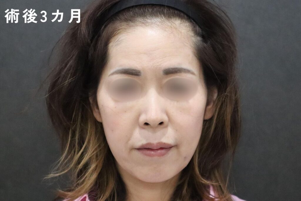 術後写真