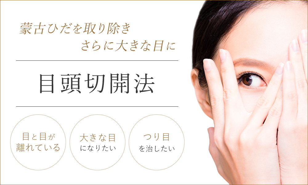 目頭切開法で蒙古ひだを取り除き、さらに大きな目に。