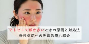 アトピーで顔が赤いときの原因と対処法｜慢性炎症への先進治療も紹介