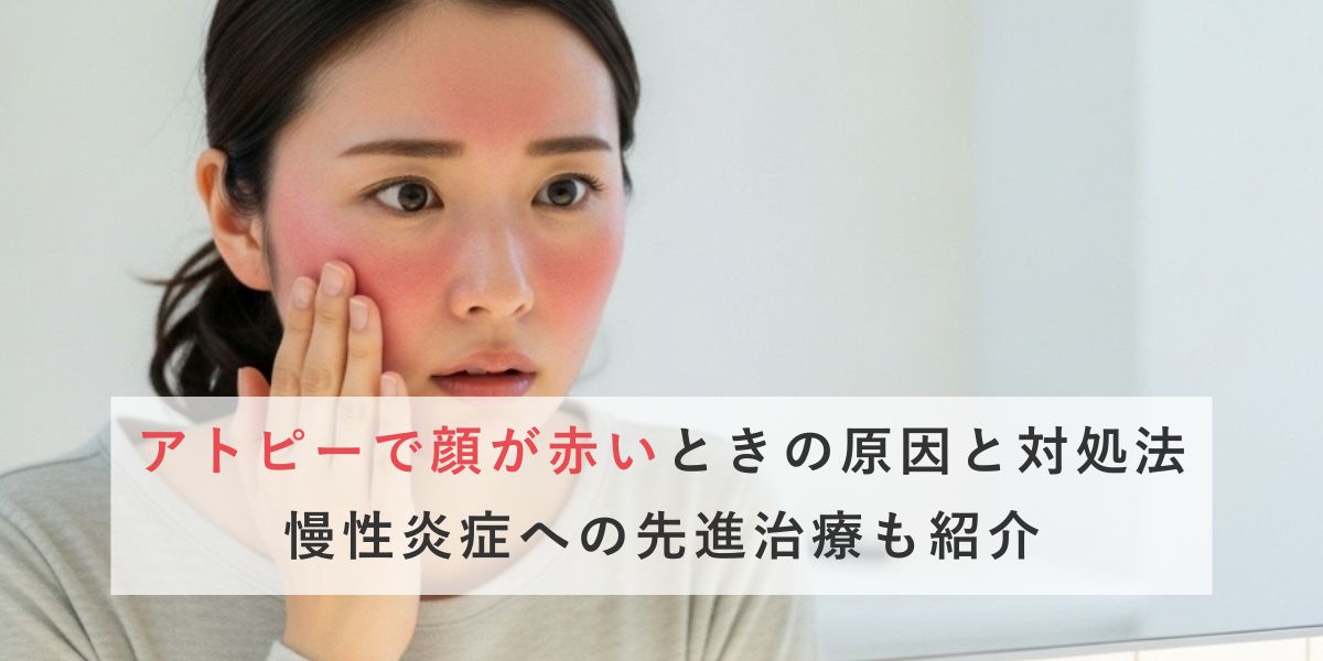 アトピーで顔が赤い…その原因と治し方｜慢性赤み・炎症に悩む方へ医師が解説